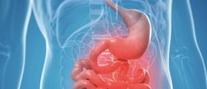 Which Bariatric Surgery is Best for Long-Term Weight Loss?